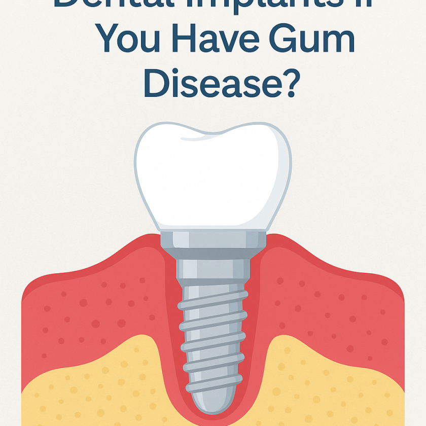 Illustration showing a dental implant and gumline with the title “Can You Get Dental Implants If You Have Gum Disease?” and Coppice View Dental branding.